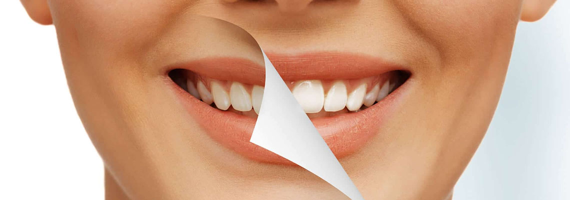 Full mouth restoration in australia basal implants in india