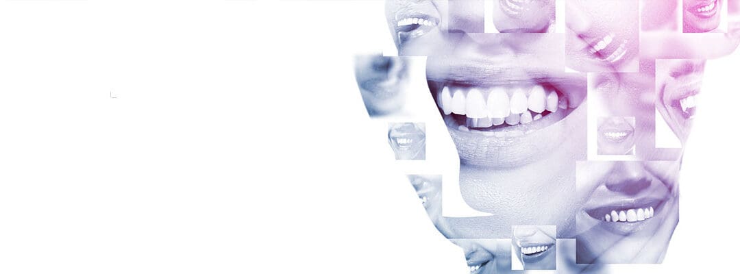 Smile Design Dentistry in India – What’s Included?
