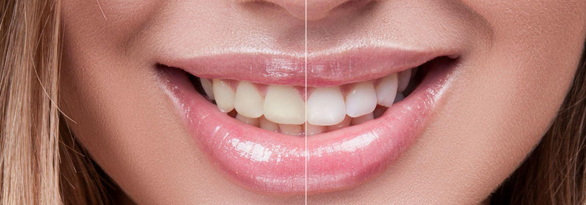 perfect smile dentistry