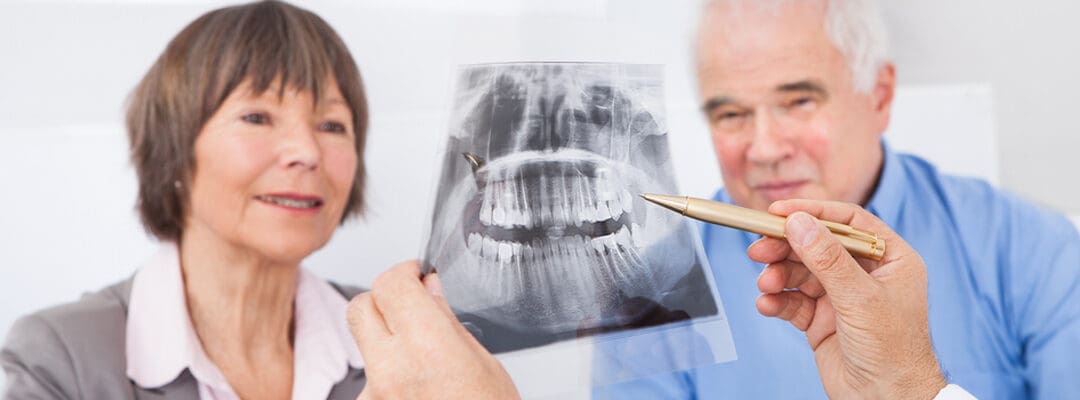 candidacy for dental implants