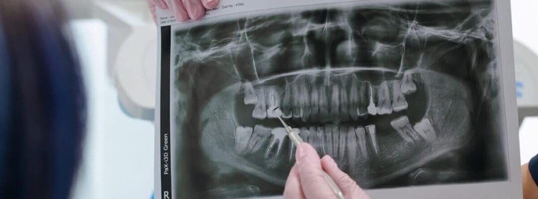 are the dental X-rays safe