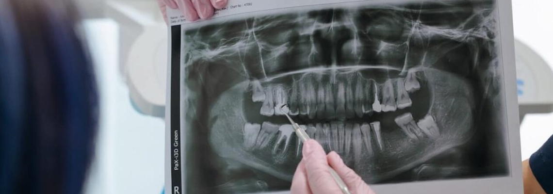 are the dental X-rays safe