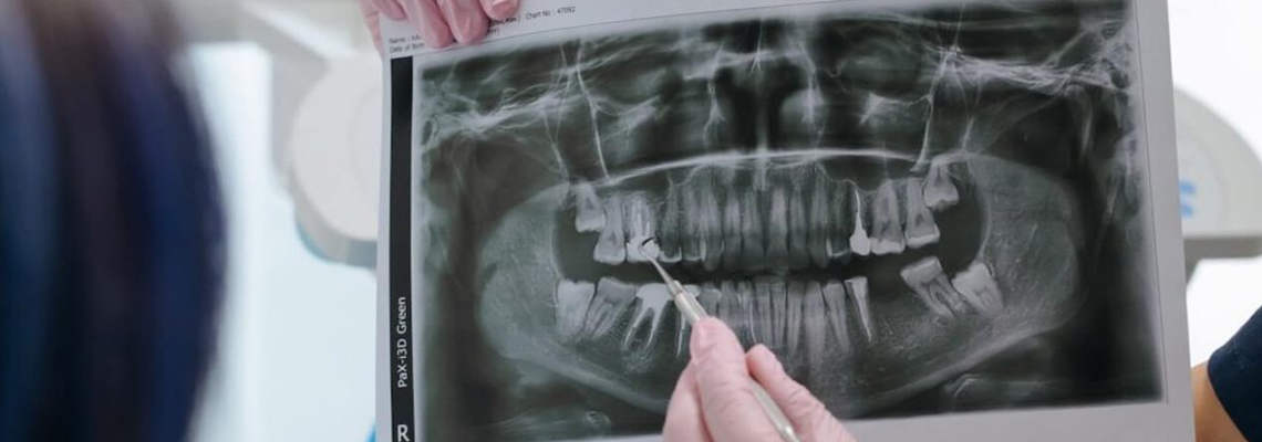 Are the dental x-rays safe