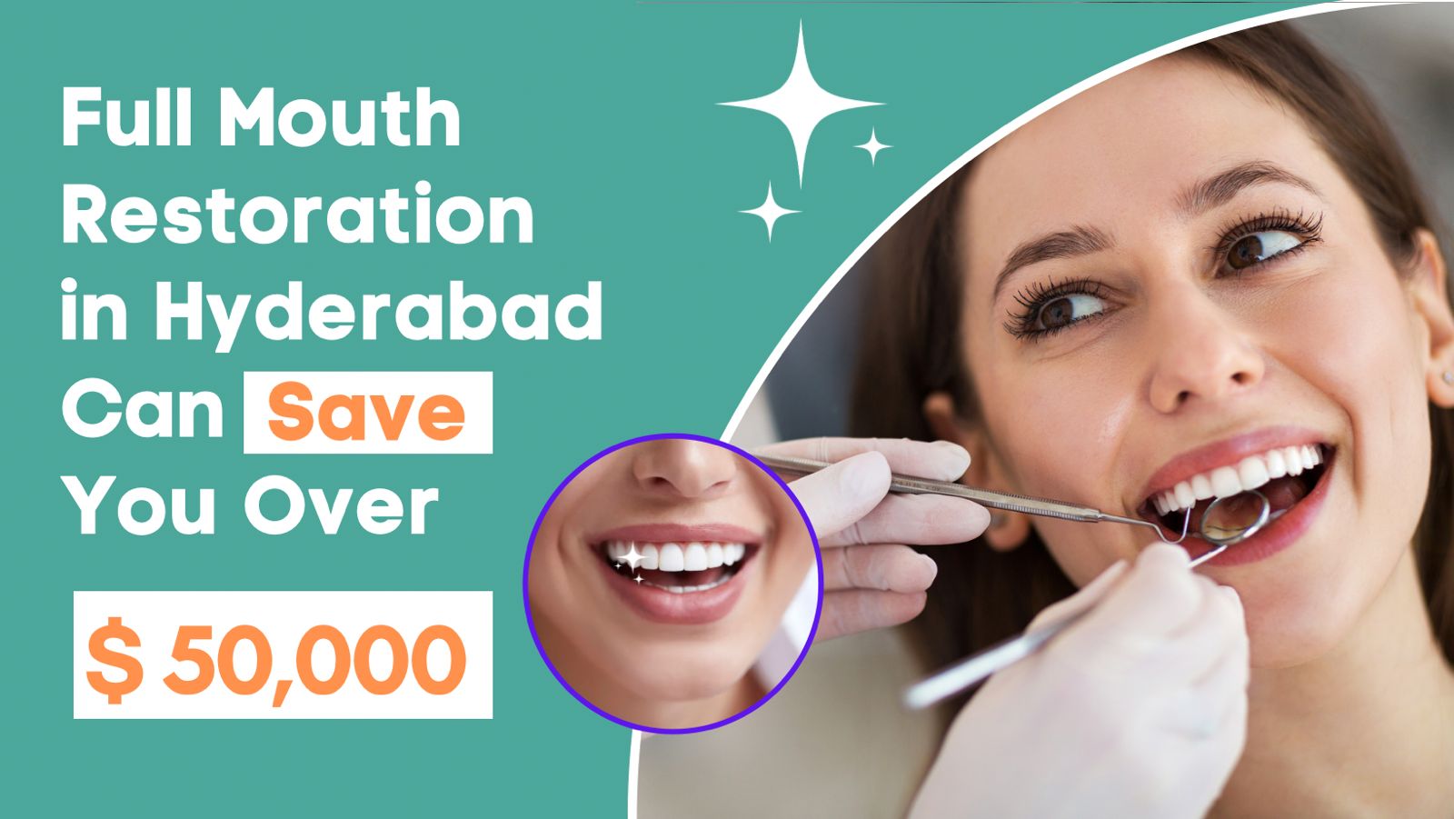 Full Mouth Restoration in Hyderabad Can Save You Over $50k!