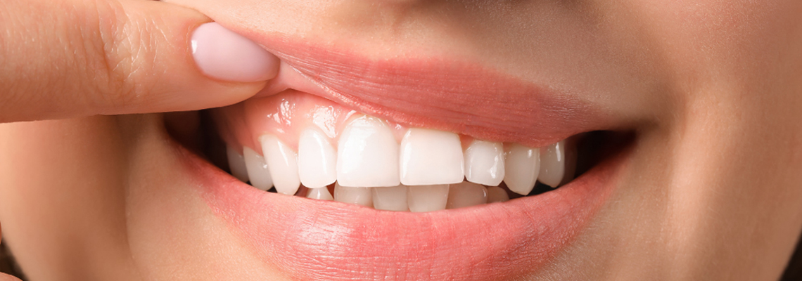 swollen gums treatment