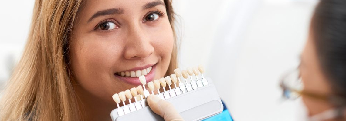 Fix smile issues with veneers