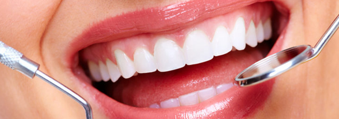 Common cosmetic dentistry