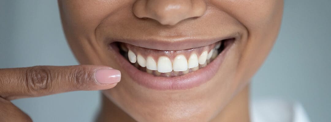 Importance of Keeping Gums Healthy