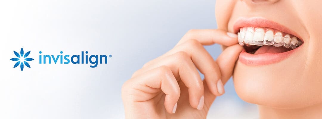 5 Lesser Known Benefits of Invisalign