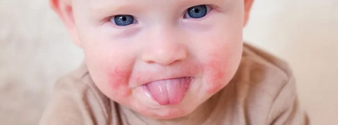 Teething Relief for Tiny Tots!