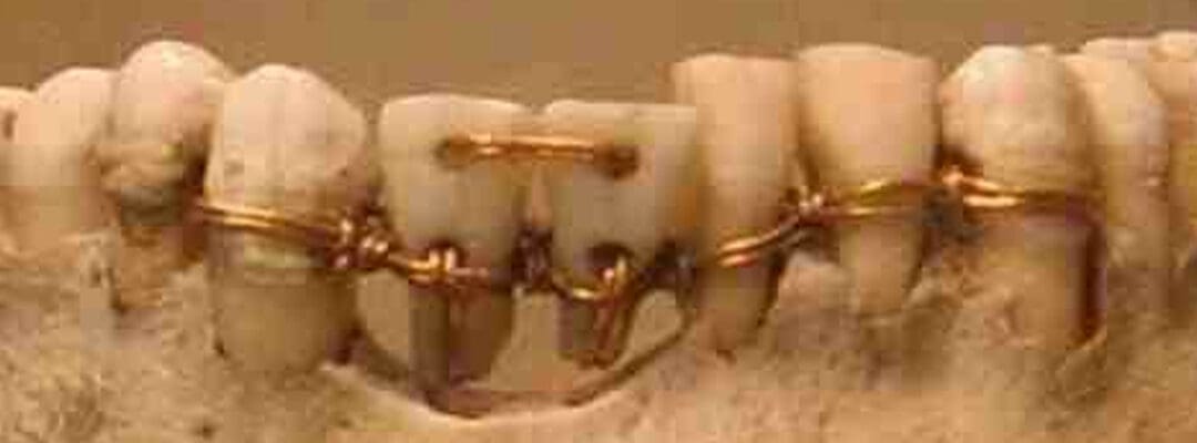 Dental Health in Ancient Civilizations