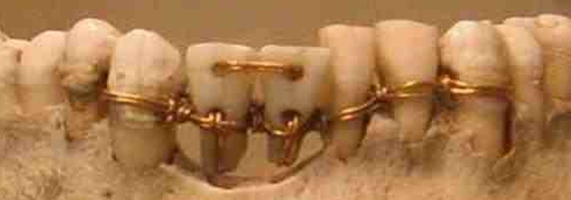 Dental health in ancient civilizations