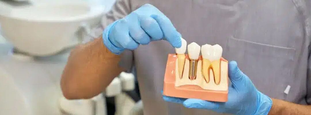 Dental Implants & TMJ: Improving Jaw Function