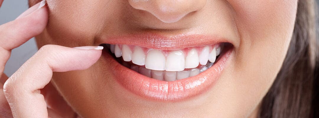 Smile Makeovers: Enhancing Your Smile for Life Events