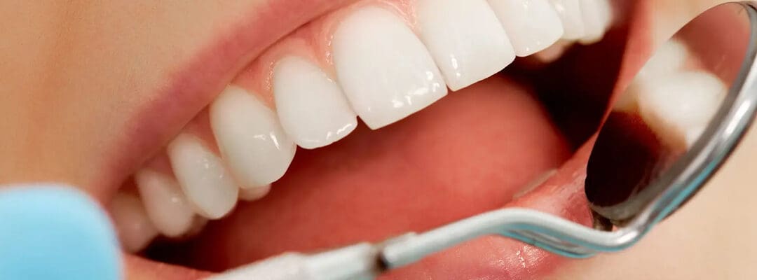 The Role of Gut Health in Oral Hygiene