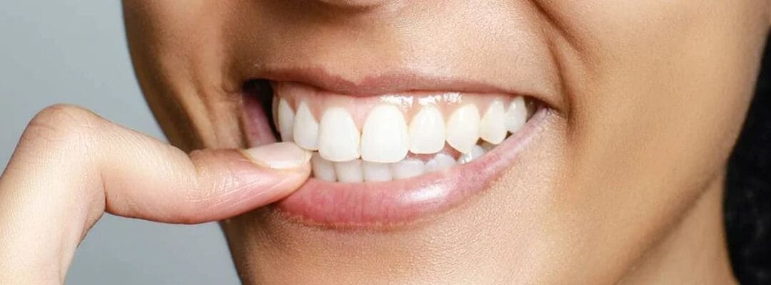 Basal Implants: Restoring Smiles and Rebuilding Confidence