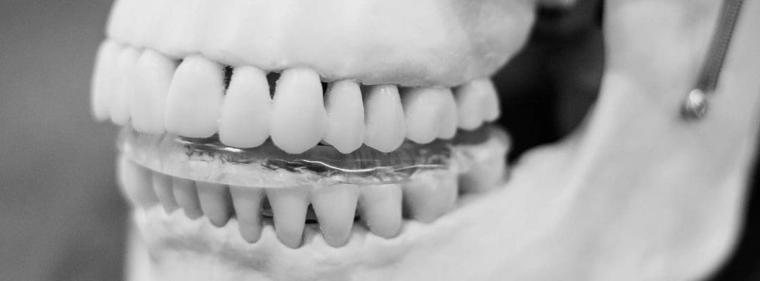 Is Your Jaw the Root of Your Headaches: The TMJ Connection