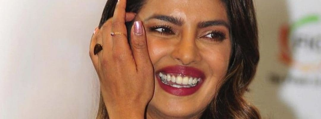 Bollywood Smiles: How Indian Celebrities Get Perfect Teeth