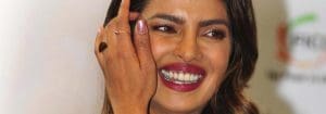 Bollywood Smiles: How Indian Celebrities Get Perfect Teeth
