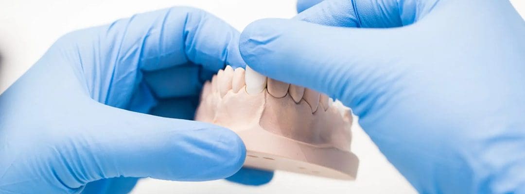 Zirconia vs. Porcelain: The Truth About Which Looks More Natural