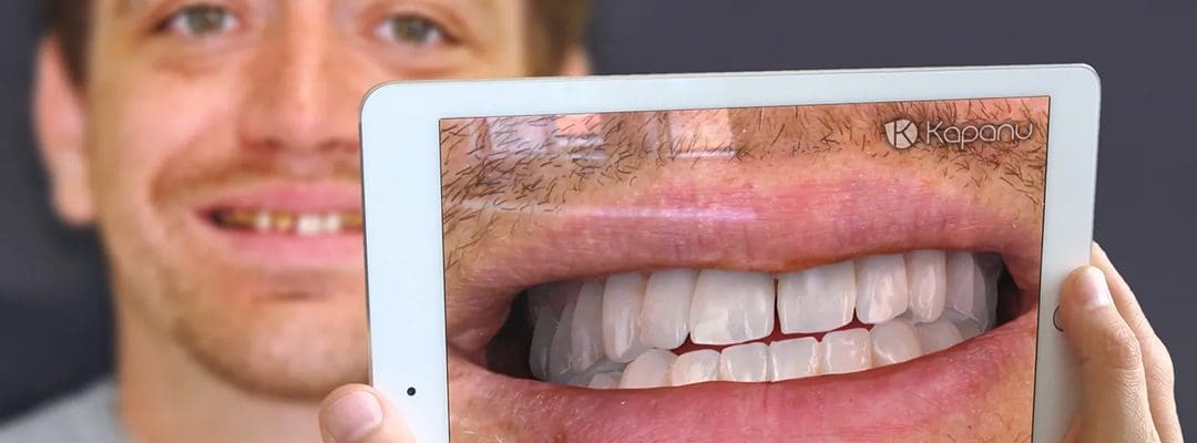 Digital Smile Trial: Test Your New Smile in VR Before Committing