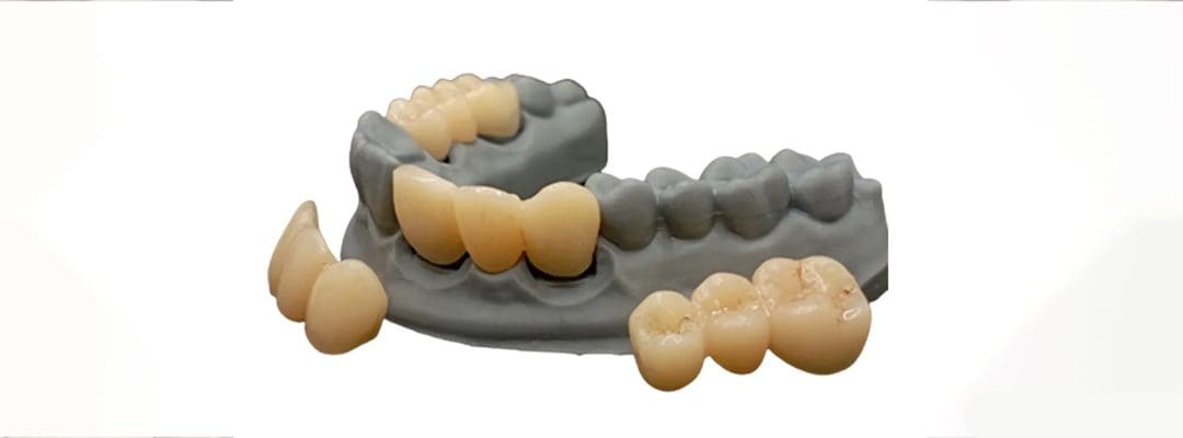 How 3D Printing Lets Us Replicate Your Lost Youthful Smile